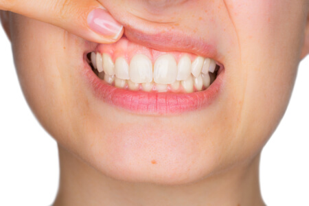 Proper oral hygiene assures healthy gums and healthy teeth.