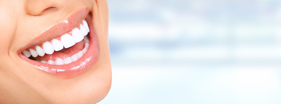 Sie erhalten ein strahlendes Lächeln mit weissen Zähnen, wenn Sie Karies frühzeitig erkennen, entfernen und künftig vermeiden.
